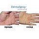 ДермаСпрей Интензив (DermaSpray Intensive) спрей при проблемна кожа